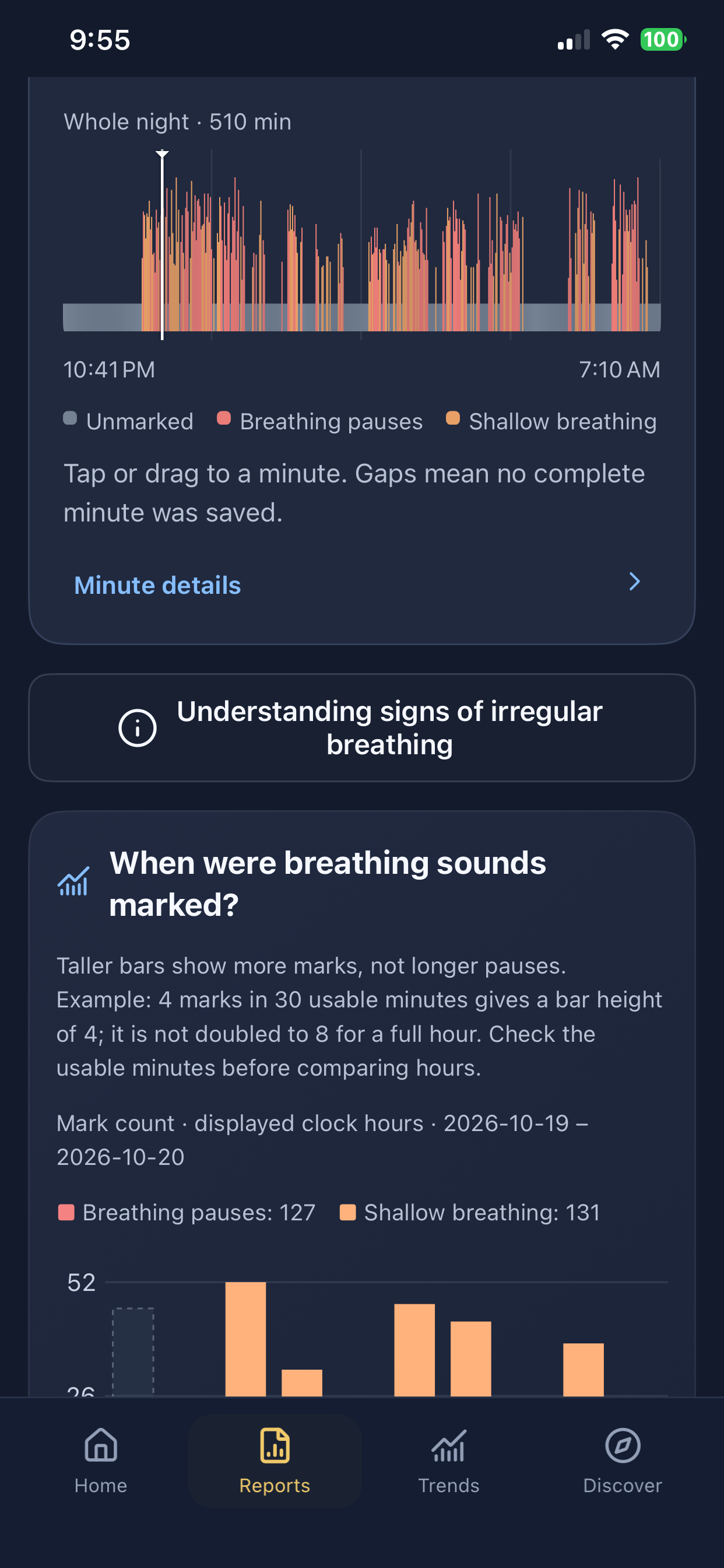 iPhone whole-night interface example: separate breathing pause and shallow breathing sound marks across a 510-minute recording.